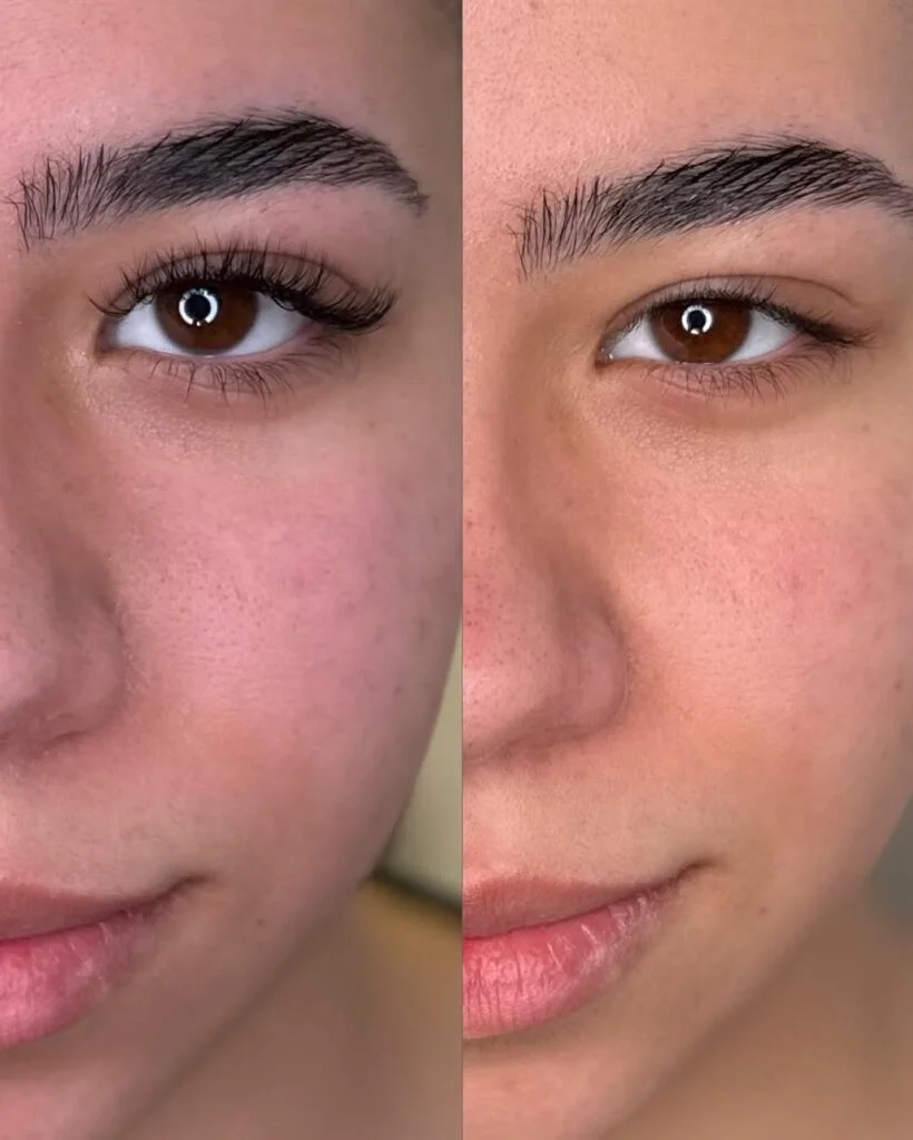 Vorher-Nachher-Vergleich einer Wimpernbehandlung